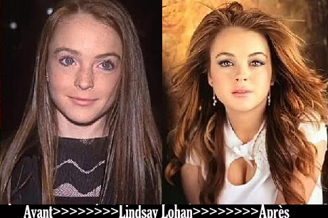 Avant après «Lindsay Lohan»